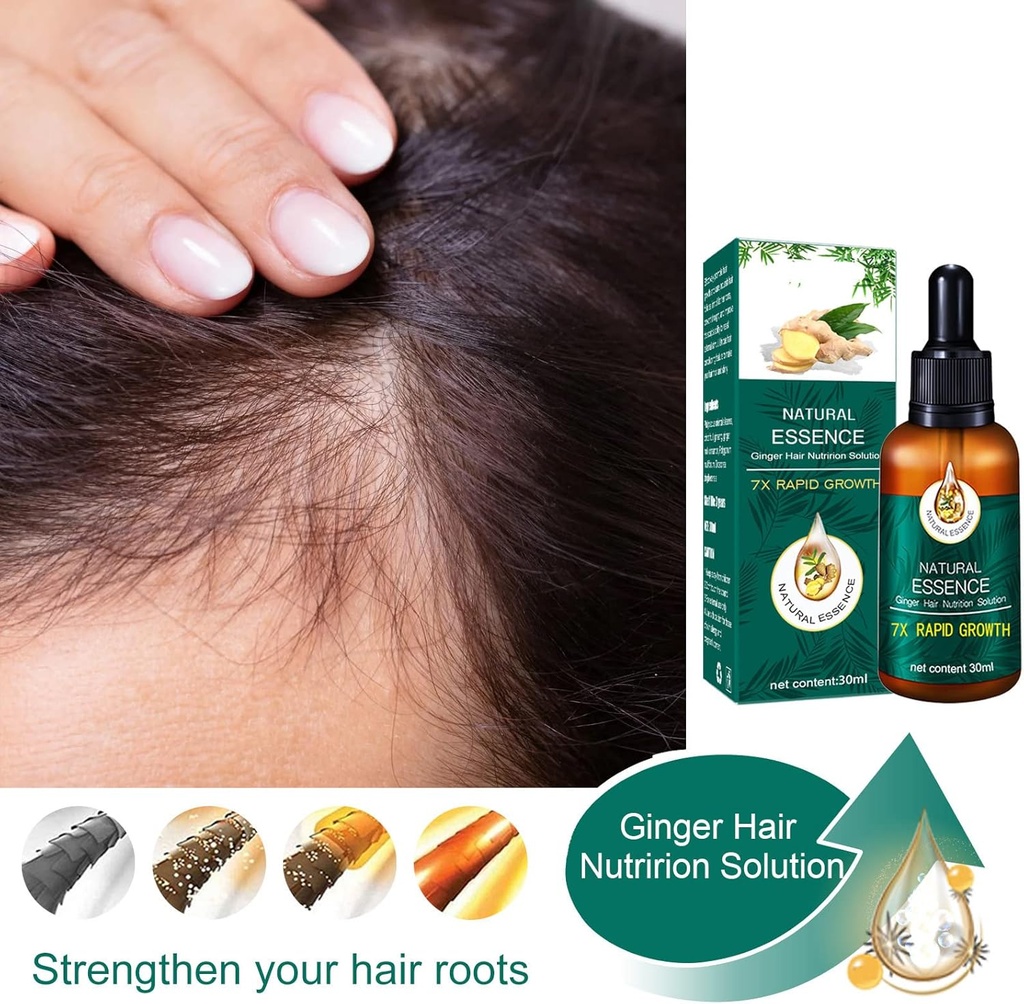 Sérum de croissance capillaire, 30ml, huiles essentielles, gingembre, perte de cheveux, nourrissant, adoucissant, réparation du cuir chevelu, soins capillaires endommagés