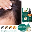 Sérum de croissance capillaire, 30ml, huiles essentielles, gingembre, perte de cheveux, nourrissant, adoucissant, réparation du cuir chevelu, soins capillaires endommagés