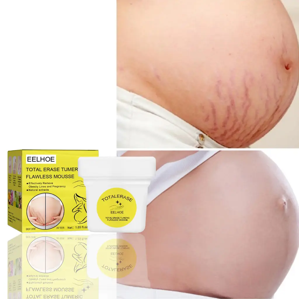 Stretch Mark Crème Anti-Fading, Crème Raffermissante Bio Flawless, Ingrédient Naturel, Raffermissant et Hydratant, Efficacité Rapide pour Améliorer la Peau, Boost Confiance 2Pcs