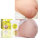 Stretch Mark Crème Anti-Fading, Crème Raffermissante Bio Flawless, Ingrédient Naturel, Raffermissant et Hydratant, Efficacité Rapide pour Améliorer la Peau, Boost Confiance 2Pcs