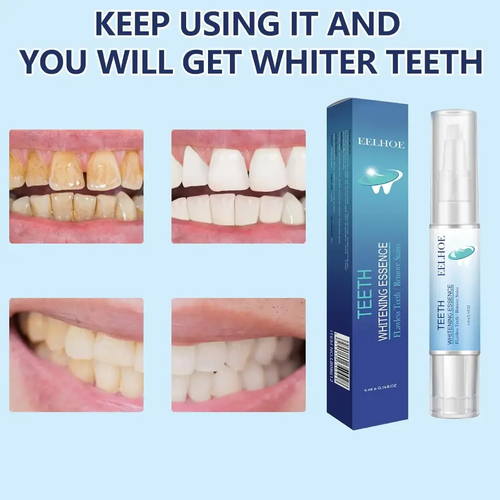 Stylo Blanchiment Dents,Stylo de Blanchiment Dentaire Teeth Whitening Pen Professionnel Stylo Blancheur Dents Blanchiment Dentaire Blanchir Les Dents Blanchiment, Blanchiment Dents Efficace