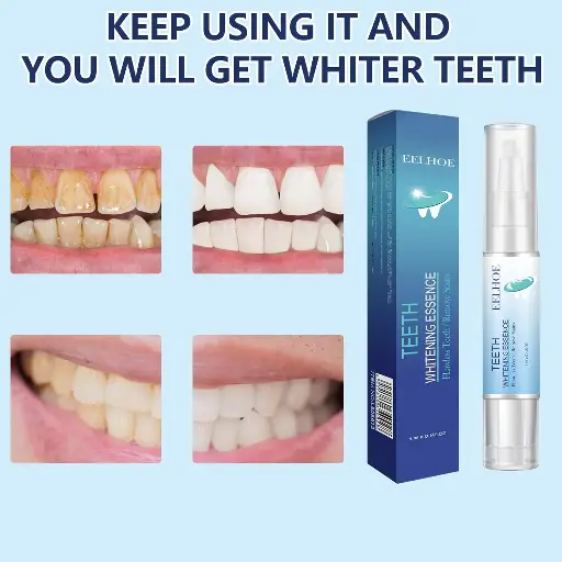 Stylo Blanchiment Dents,Stylo de Blanchiment Dentaire Teeth Whitening Pen Professionnel Stylo Blancheur Dents Blanchiment Dentaire Blanchir Les Dents Blanchiment, Blanchiment Dents Efficace